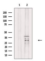 ABHD14A Polyclonal Antibody