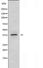 ABHD9 Polyclonal Antibody