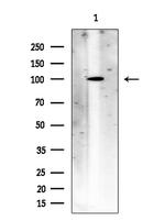 ACSS1 Polyclonal Antibody