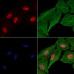 PHAPI2 Polyclonal Antibody