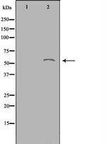 ACOT2 Polyclonal Antibody