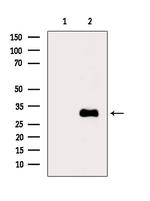 ACOT8 Polyclonal Antibody