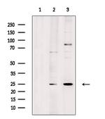 LYPLA1 Polyclonal Antibody