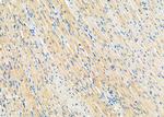 LPCAT2 Antibody in Immunohistochemistry (Paraffin) (IHC (P))