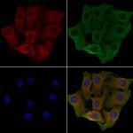 ARFGAP1 Polyclonal Antibody