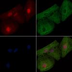 ARL2BP Polyclonal Antibody