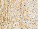 ARL2BP Antibody in Immunohistochemistry (Paraffin) (IHC (P))