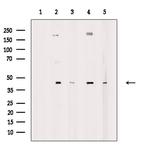 AARSD1 Antibody in Western Blot (WB)