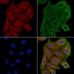 AMPD2 Polyclonal Antibody