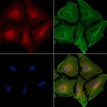 Amphiphysin Polyclonal Antibody