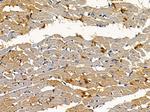 Amphiphysin Antibody in Immunohistochemistry (Paraffin) (IHC (P))
