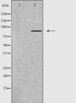 APLP2 Polyclonal Antibody