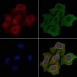 AIG1 Polyclonal Antibody