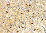 Apolipoprotein L1 Antibody in Immunohistochemistry (Paraffin) (IHC (P))