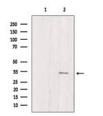ATP Synthase gamma Antibody in Western Blot (WB)