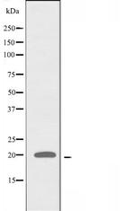 ATP5L2 Polyclonal Antibody