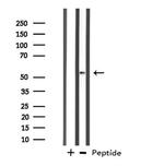 DDX19B Antibody in Western Blot (WB)