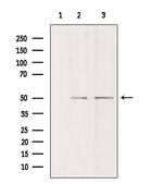 DDX19B Polyclonal Antibody