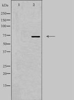 DDX51 Antibody in Western Blot (WB)
