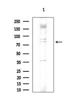 DDX51 Polyclonal Antibody