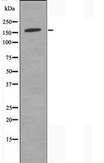 DHX8 Polyclonal Antibody