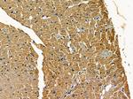 Atrophin 1 Polyclonal Antibody