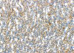BNIP2 Antibody in Immunohistochemistry (Paraffin) (IHC (P))
