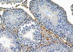 BNIP2 Polyclonal Antibody