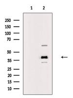 B4GALT5 Polyclonal Antibody