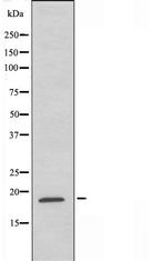 GUSBP1 Polyclonal Antibody