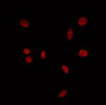 BAZ2A Polyclonal Antibody