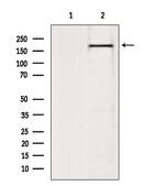 BAZ2A Antibody in Western Blot (WB)