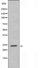 CABP7 Polyclonal Antibody