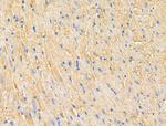 PNPLA8 Antibody in Immunohistochemistry (Paraffin) (IHC (P))