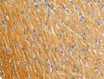 PNPLA8 Antibody in Immunohistochemistry (Paraffin) (IHC (P))