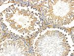 PNPLA8 Antibody in Immunohistochemistry (Paraffin) (IHC (P))