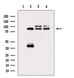 PNPLA8 Antibody in Western Blot (WB)
