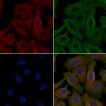 Calpain 11 Polyclonal Antibody