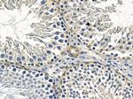 Calpain 11 Antibody in Immunohistochemistry (Paraffin) (IHC (P))