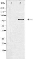 Calpain 11 Antibody in Western Blot (WB)