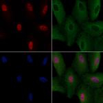 Calpain 12 Polyclonal Antibody