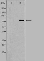 Calpain 12 Antibody in Western Blot (WB)