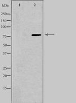 Calpain 9 Polyclonal Antibody
