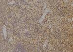 ARPP21 Antibody in Immunohistochemistry (Paraffin) (IHC (P))