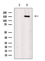CLIP1 Polyclonal Antibody