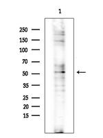 CHST2 Antibody in Western Blot (WB)