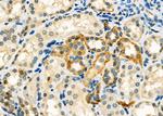 CA12 Polyclonal Antibody