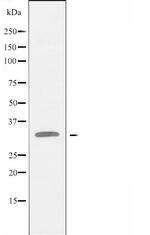 Carbonic Anhydrase XIV Polyclonal Antibody