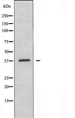 Carbonic Anhydrase III Antibody in Western Blot (WB)