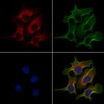 Carbonic Anhydrase VA Polyclonal Antibody